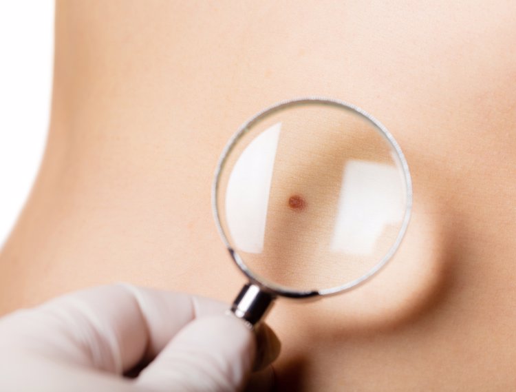 脖子上長的“小肉粒”是什么？能直接用手揪